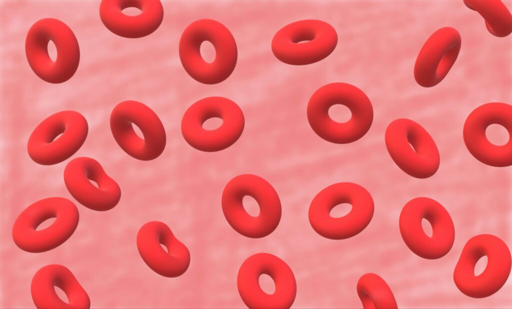 缺鐵性貧血怎麼辦？鐵劑推薦讓你補鐵