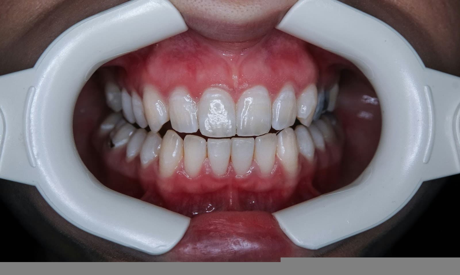 Photo by Ozkan Guner on Unsplash 