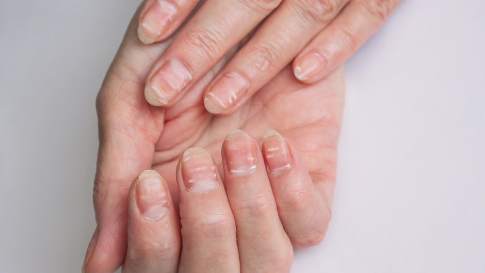 養甲懶人包！營養師解析4大與指甲健康相關的營養素