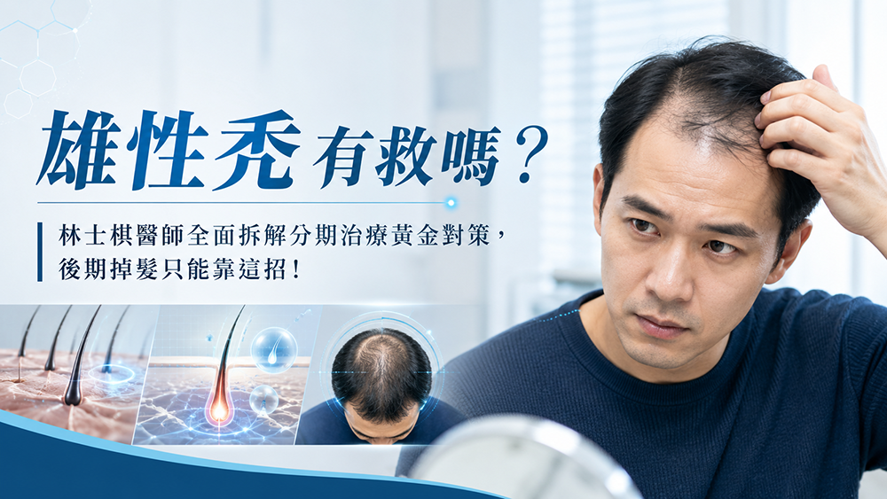 雄性禿怎麼辦？醫師解析不同階段的落髮管理方式